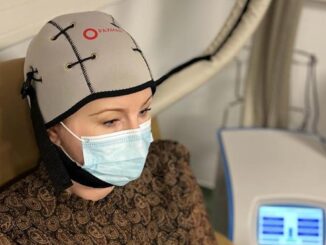Dispozitivul care previne căderea părului. FOTO OncoHelp