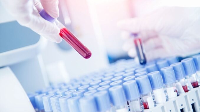 Analize de sânge. FOTO Arhivă